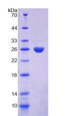 Rat PRTN3 / Myeloblastin Protein (Recombinant His)