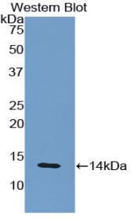 B2M / Beta 2 Microglobulin Antibody (aa22-119)