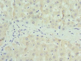 PAICS / ADE2 Antibody