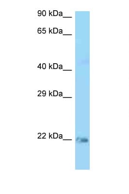 KRAS Antibody (aa61-110)