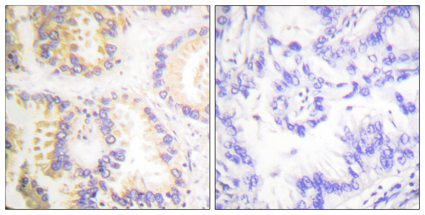 CASP8 / Caspase 8 Antibody (phospho-Ser347)
