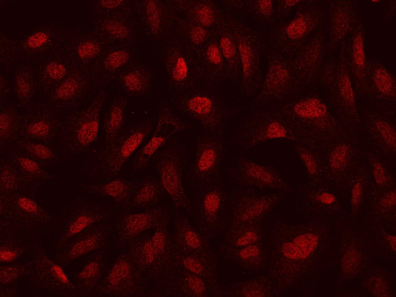 SEPHS2 Antibody