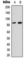 MPO / Myeloperoxidase Antibody (Internal)