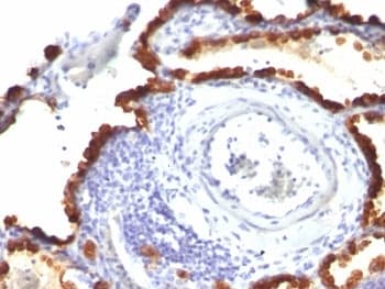 KRT7 / CK7 / Cytokeratin 7 Antibody (clone KRT7/760 + KRT7/903)