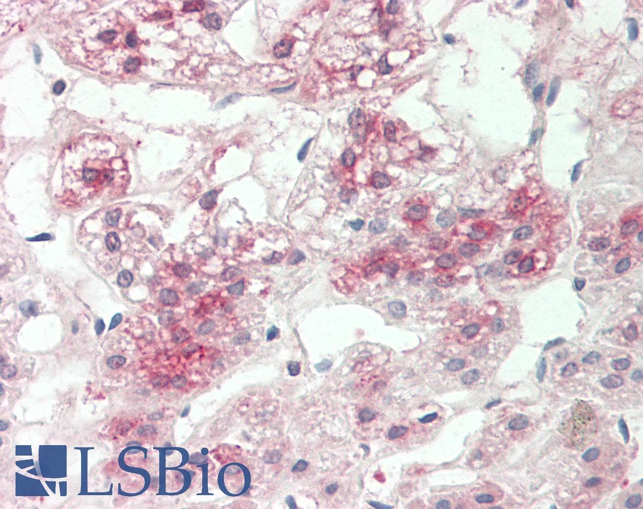 PDI / P4HB Antibody (aa101-150)