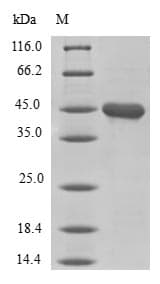 Human LOX / Lysyl Oxidase Protein (Recombinant 10His-SUMO, N-terminus + Myc, C-terminus)