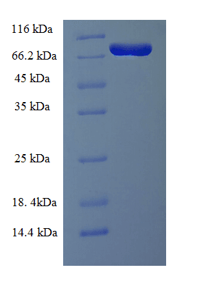 Human LCP1 / L-Plastin Protein (Recombinant His)
