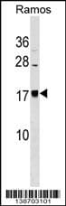 Polyclonal Rabbit anti-Human BLACE Antibody (aa 15-41, N-term, WB)