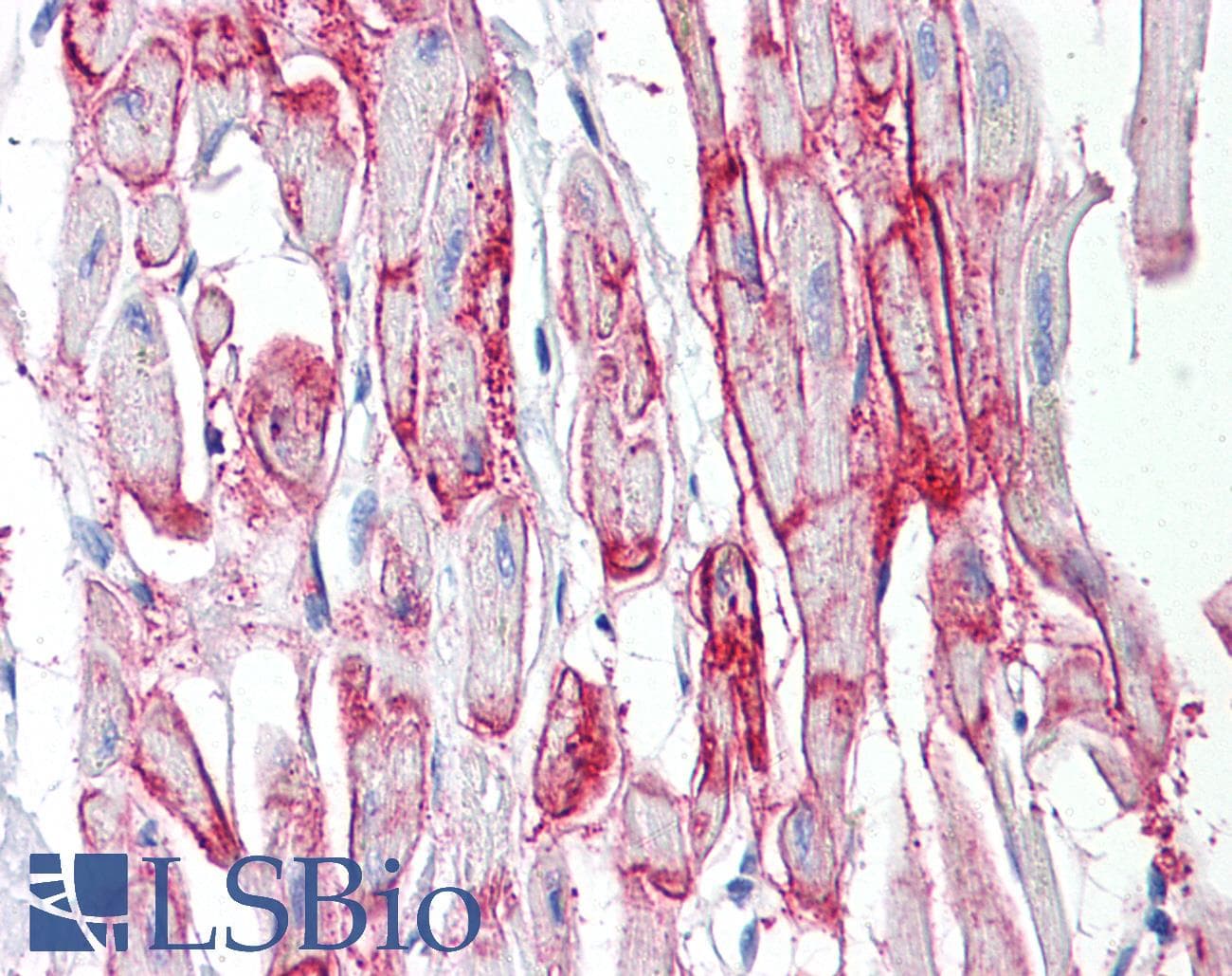 IHC-plus™ Polyclonal Rabbit anti-Human GJA1 / CX43 / Connexin 43 Antibody (aa333-382, IHC, IF, WB)