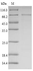 Human SERPINB4 / SCCA1+2 Protein (Recombinant 6His-SUMO, N-terminus)