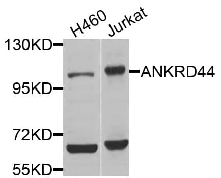 Polyclonal Rabbit anti-Human ANKRD44 Antibody (WB)