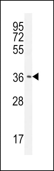 CNOT7 Antibody (aa34-61)