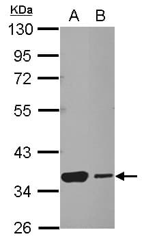 HSF2BP Antibody