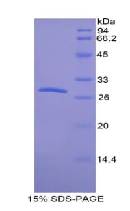 Mouse CDH3 / P-Cadherin Protein (Recombinant His)