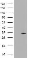 UCK1 Antibody (clone OTI7E11)