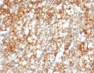 Basigin / Emmprin / CD147 Antibody (clone BSG/963, Ready-to-Use)