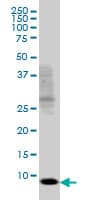 Monoclonal Mouse anti-Human SH2D1A / SAP Antibody (clone 1C9, WB)