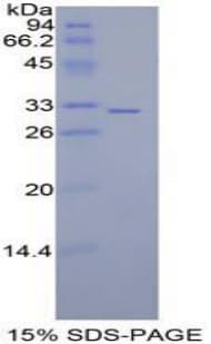 Mouse MAP2K7 / MEK7 Protein (Recombinant His-T7)