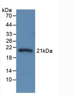 SERPINA6 / CBG Antibody