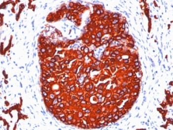 Pan Cytokeratin Antibody (clone KRTL/1077 + KRTH/1076)