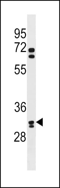 OR6B2 Antibody (aa278-304)