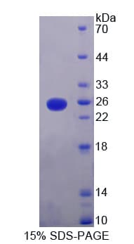 Human KRAS Protein (Recombinant His-T7)