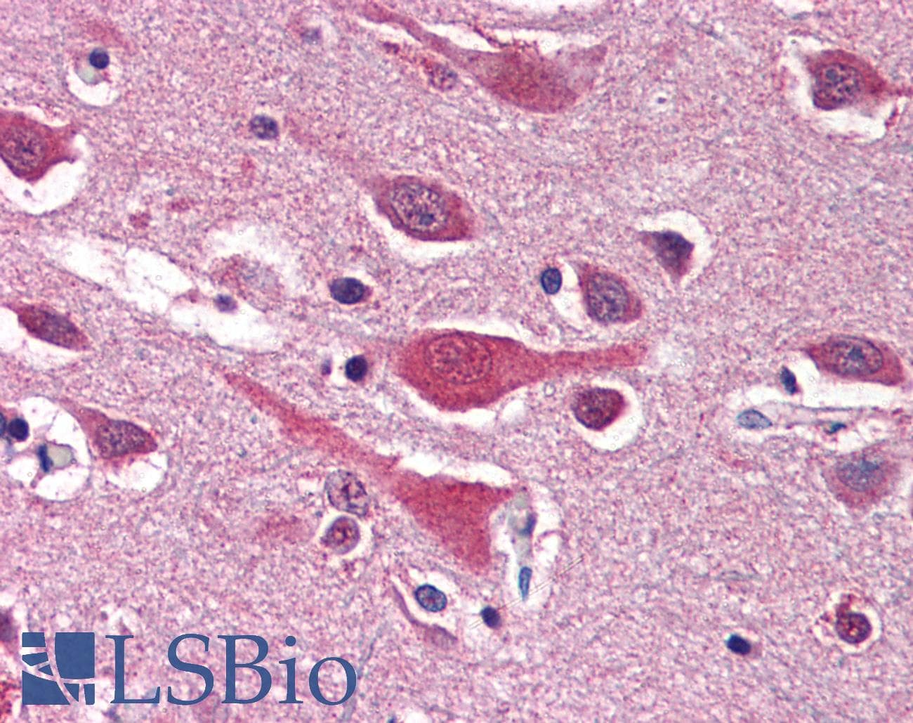 IHC-plus™ LAP1 / LRRC7 Antibody (N-Terminus)