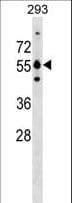 GRWD1 Antibody (aa183-209)