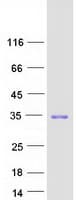 Human CDKN1B / p27 Kip1 Protein (Recombinant Myc-DDK (Flag))