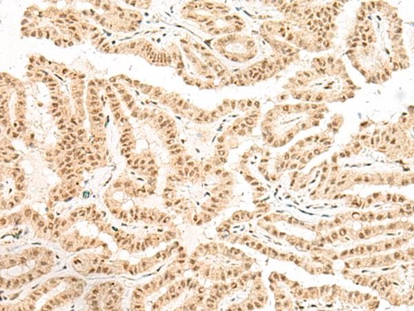 GLTSCR1 Antibody