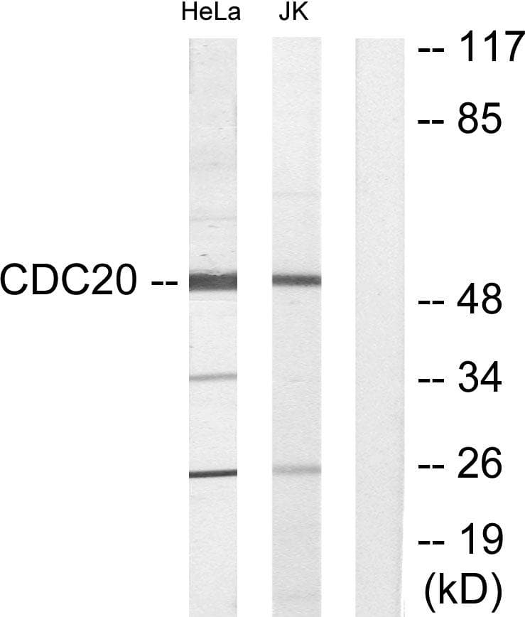 Polyclonal Rabbit anti-Human CDC20 Antibody (WB)