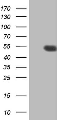 Monoclonal Mouse anti-Human HDAC3 Antibody (clone OTI4E10, aa1-235, WB)