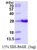 Human GSTA4 Protein (Recombinant His)