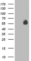 Nectin-1 / PVRL1 Antibody (clone OTI6E11, Carrier-free)