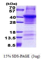 Human REN / Renin 1 Protein (Recombinant His)