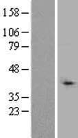 TBL1XR1 / TBLR1 Protein (Over-Expression Lysate Myc-DDK (Flag))
