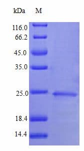 Human IFNA1 / Interferon Alpha 1 Protein (Recombinant)