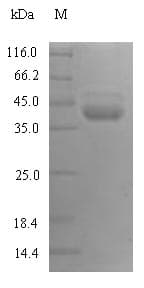 Human KLKB1 / Plasma Kallikrein Protein (Recombinant 6His, N-terminus)