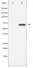 LIMK2 Antibody