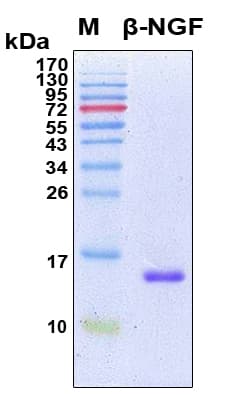Human NGF Protein (Recombinant 6His, N-terminus)