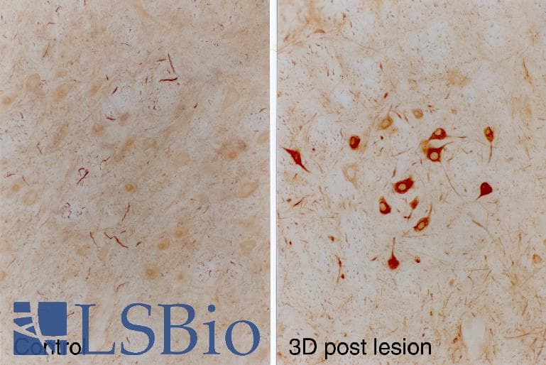 IHC-plus™ INA / Alpha Internexin Antibody (clone 2E3)