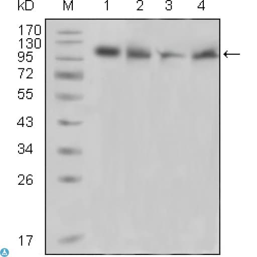 Monoclonal Mouse anti-Human PTK2B / PYK2 Antibody (IHC, WB)