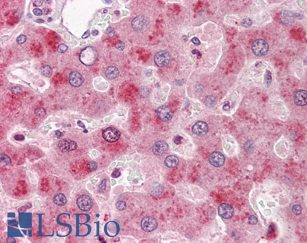 IHC-plus™ F9 / Factor IX Antibody (clone 13F42-F6)