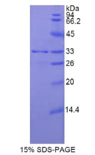 Rat SMMHC / MYH11 Protein (Recombinant His)