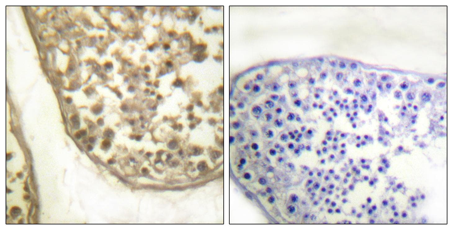 CSNK2B / Phosvitin Antibody (phospho-Ser209)