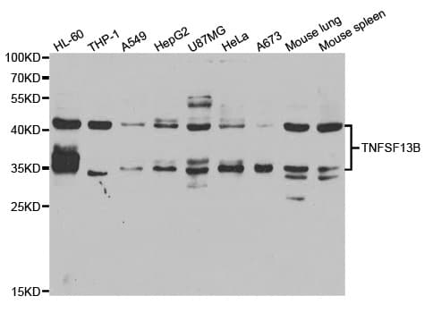 Polyclonal Rabbit anti-Human BAFF / TNFSF13B Antibody (IHC, WB)