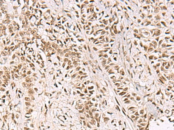 GABPB1 Antibody