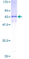 Human ANXA9 Protein (Recombinant GST)