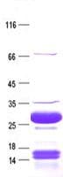 Human Gastrin Releasing Peptide Protein (Recombinant ABP-His, N-terminus)