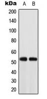 Polyclonal Rabbit anti-Human ACOT2 Antibody (Internal, IHC, IF, WB)